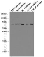 ETV5 Antibody in Western Blot (WB)