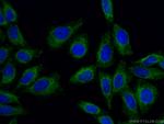 TOMM40 Antibody in Immunocytochemistry (ICC/IF)