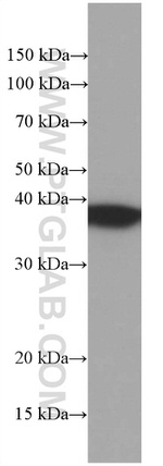 TOMM40 Antibody in Western Blot (WB)