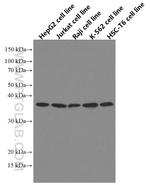 MYD88 Antibody in Western Blot (WB)