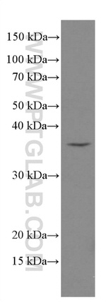 MYD88 Antibody in Western Blot (WB)