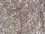 STK4 Antibody in Immunohistochemistry (Paraffin) (IHC (P))
