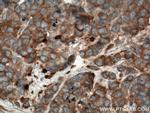 STK4 Antibody in Immunohistochemistry (Paraffin) (IHC (P))