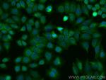 STK4 Antibody in Immunocytochemistry (ICC/IF)