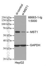 STK4 Antibody in Western Blot (WB)
