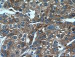 PDIA6 Antibody in Immunohistochemistry (Paraffin) (IHC (P))