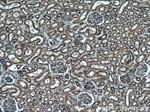 PDIA6 Antibody in Immunohistochemistry (Paraffin) (IHC (P))