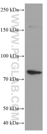PLZF Antibody in Western Blot (WB)