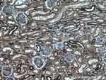 ATP5D Antibody in Immunohistochemistry (Paraffin) (IHC (P))