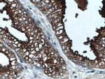 PSMA/GCPII Antibody in Immunohistochemistry (Paraffin) (IHC (P))