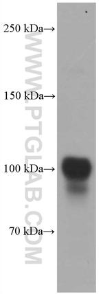 PSMA/GCPII Antibody in Western Blot (WB)