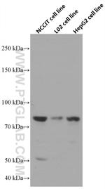BBS10 Antibody in Western Blot (WB)