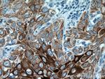 Cytokeratin 13 Antibody in Immunohistochemistry (Paraffin) (IHC (P))