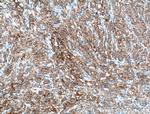 Cytokeratin 6A Antibody in Immunohistochemistry (Paraffin) (IHC (P))