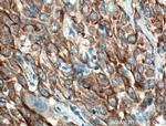 Cytokeratin 6A Antibody in Immunohistochemistry (Paraffin) (IHC (P))