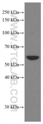 Cytokeratin 6A Antibody in Western Blot (WB)