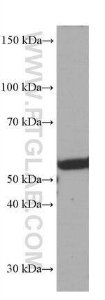 FKBP8 Antibody in Western Blot (WB)