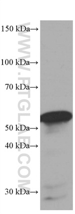 FKBP8 Antibody in Western Blot (WB)