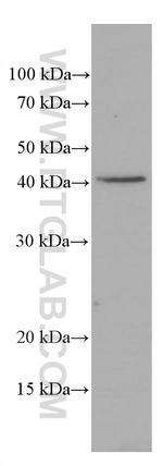 ASGR1 Antibody in Western Blot (WB)