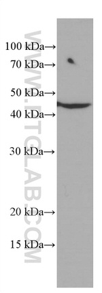 ASGR1 Antibody in Western Blot (WB)