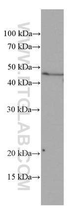 ASGR1 Antibody in Western Blot (WB)