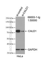 CALD1 Antibody in Western Blot (WB)