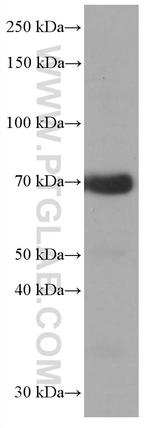 CALD1 Antibody in Western Blot (WB)
