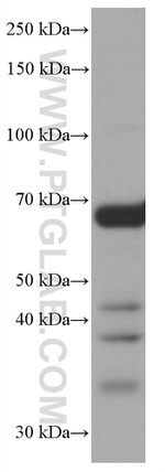 CALD1 Antibody in Western Blot (WB)