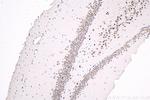 THRA Antibody in Immunohistochemistry (Paraffin) (IHC (P))