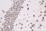 THRA Antibody in Immunohistochemistry (Paraffin) (IHC (P))
