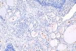 THRA Antibody in Immunohistochemistry (Paraffin) (IHC (P))