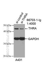 THRA Antibody in Western Blot (WB)