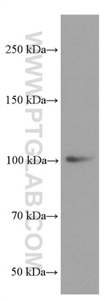 LIG4 Antibody in Western Blot (WB)