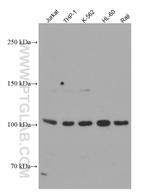 NOD2 Antibody in Western Blot (WB)