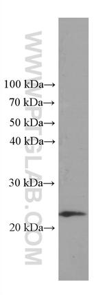 TPT1 Antibody in Western Blot (WB)
