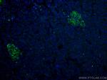 RHEB Antibody in Immunohistochemistry (PFA fixed) (IHC (PFA))