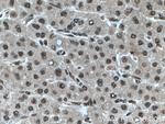 RBX1 Antibody in Immunohistochemistry (Paraffin) (IHC (P))