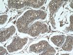 CHCHD4 Antibody in Immunohistochemistry (Paraffin) (IHC (P))