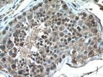CHCHD4 Antibody in Immunohistochemistry (Paraffin) (IHC (P))