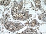STK11 Antibody in Immunohistochemistry (Paraffin) (IHC (P))