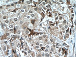 STK11 Antibody in Immunohistochemistry (Paraffin) (IHC (P))
