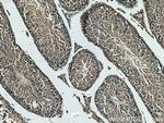 HSPH1 Antibody in Immunohistochemistry (Paraffin) (IHC (P))