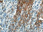Cytokeratin 5 Antibody in Immunohistochemistry (Paraffin) (IHC (P))