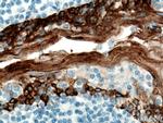 Cytokeratin 5 Antibody in Immunohistochemistry (Paraffin) (IHC (P))