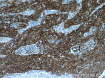 Cytokeratin 5 Antibody in Immunohistochemistry (Paraffin) (IHC (P))