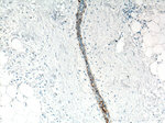 Cytokeratin 5 Antibody in Immunohistochemistry (Paraffin) (IHC (P))