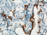 Cytokeratin 5 Antibody in Immunohistochemistry (Paraffin) (IHC (P))