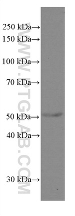 Cytokeratin 5 Antibody in Western Blot (WB)