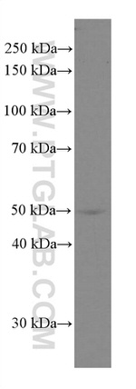 Cytokeratin 5 Antibody in Western Blot (WB)