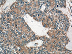 IL1 beta Antibody in Immunohistochemistry (Paraffin) (IHC (P))